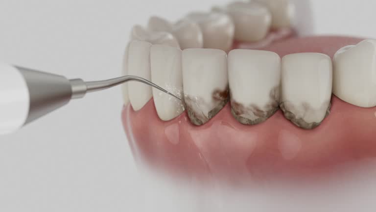 Reliable Emergency Dentist contractor in Troy, MO by Smile Center Dentistry